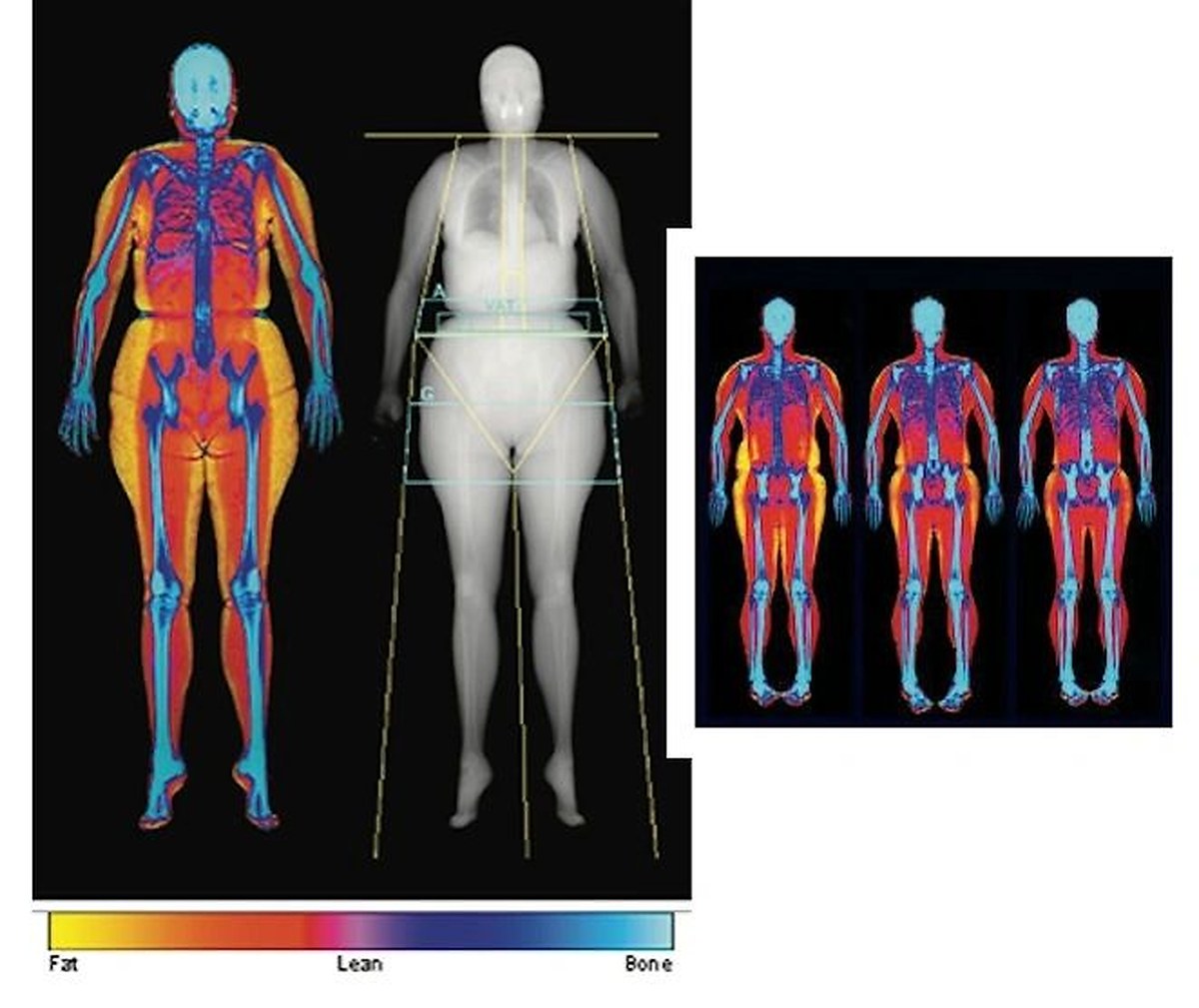 DexaFit body composition partner facility